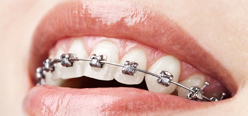 orthodontics treatment image