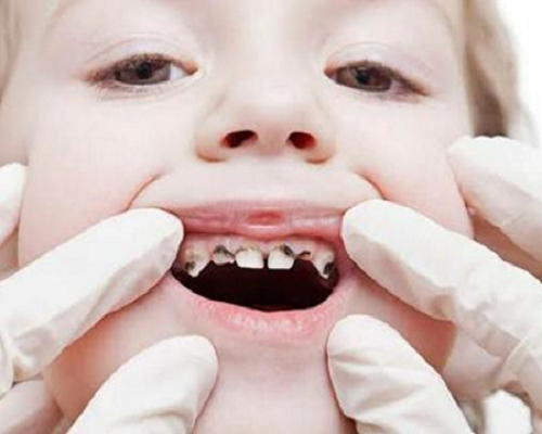 Dentist for kids