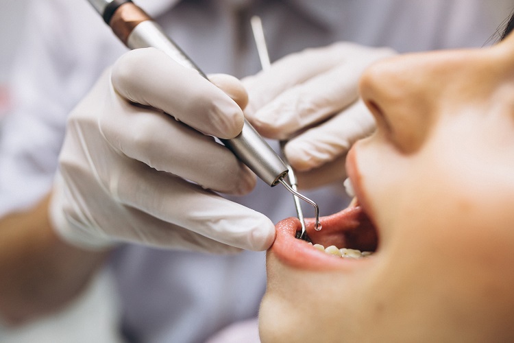 Tooth Extraction Pune