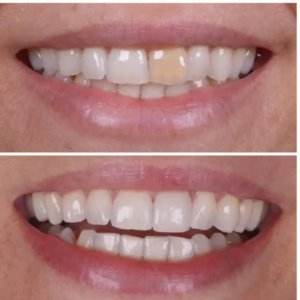 Cosmetic Dentistry