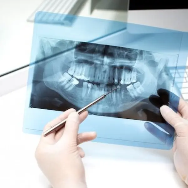 Dental X-Ray Pune