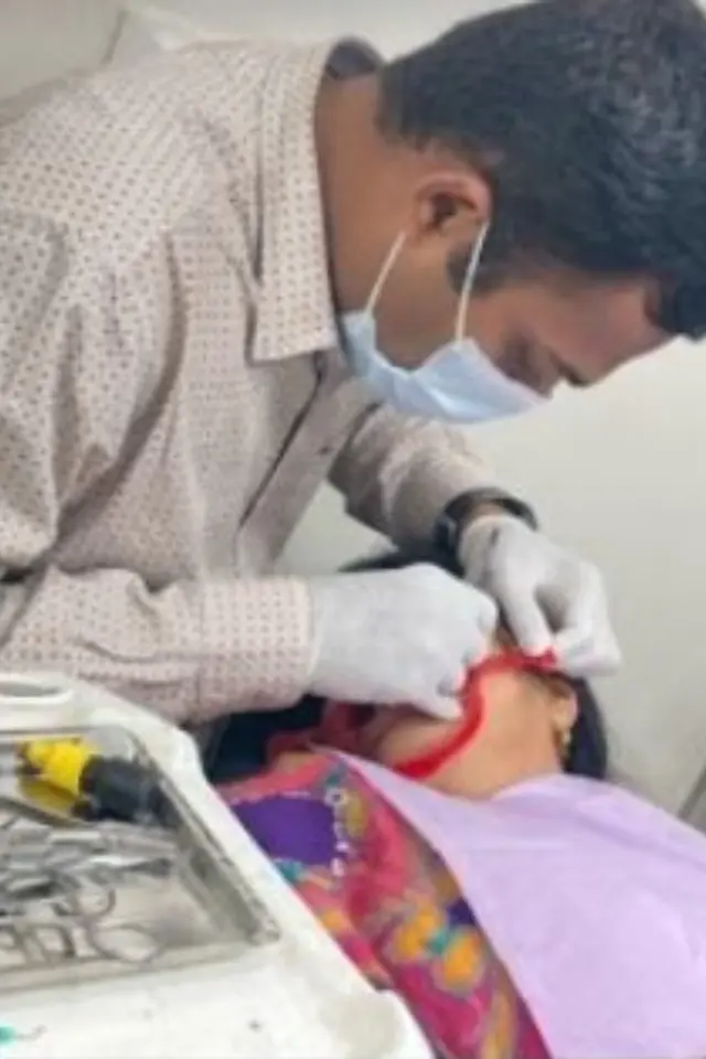 Painless Root Canal Treatment